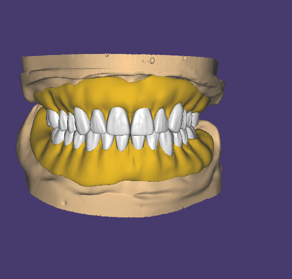 AOX Full Arch Design